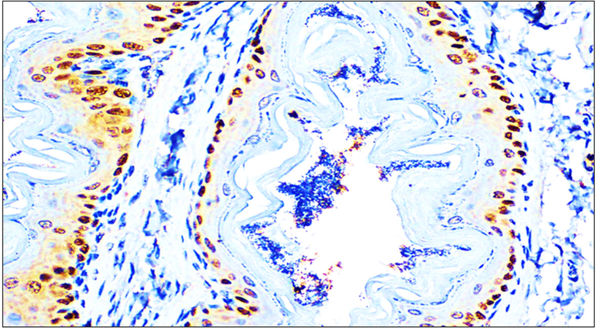 Customer feedback IR205-742 anti- p63 antibody IHC image