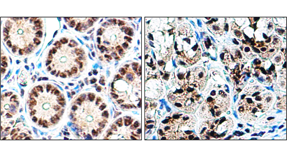 IR4-10 anti-Histone H3 antibody IHC image IR4-10 anti-Histone H3 antibody IHC image