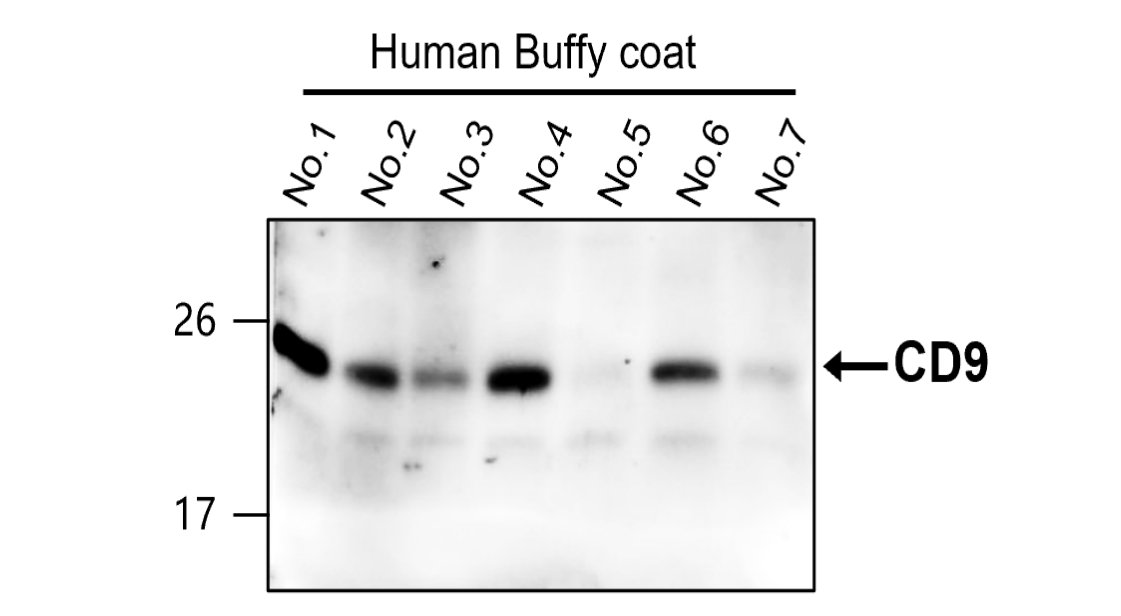 Customer Feedback IR300-981 anti-CD9 antibody WB image Customer Feedback IR300-981 anti-CD9 antibody WB image