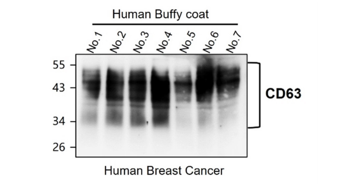 Customer Feedback IR301-983 anti-CD63 antibody WB image Customer Feedback IR301-983 anti-CD63 antibody WB image