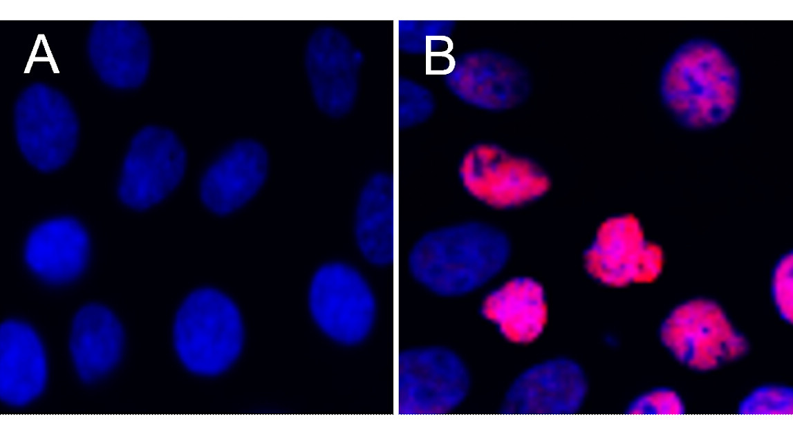 IRM004 anti- Phospho STAT3 (Tyr705) monoclonal antibody ICC/IF image IRM004 anti- Phospho STAT3 (Tyr705) monoclonal antibody ICC/IF image