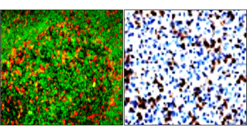 IRM005 anti- PD1 / CD279 antibody IHC image IRM005 anti- PD1 / CD279 antibody IHC image