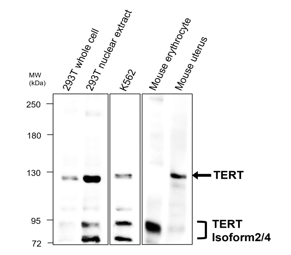 IR356-2 anti-TERT antibody WB image IR356-2 anti-TERT antibody WB image