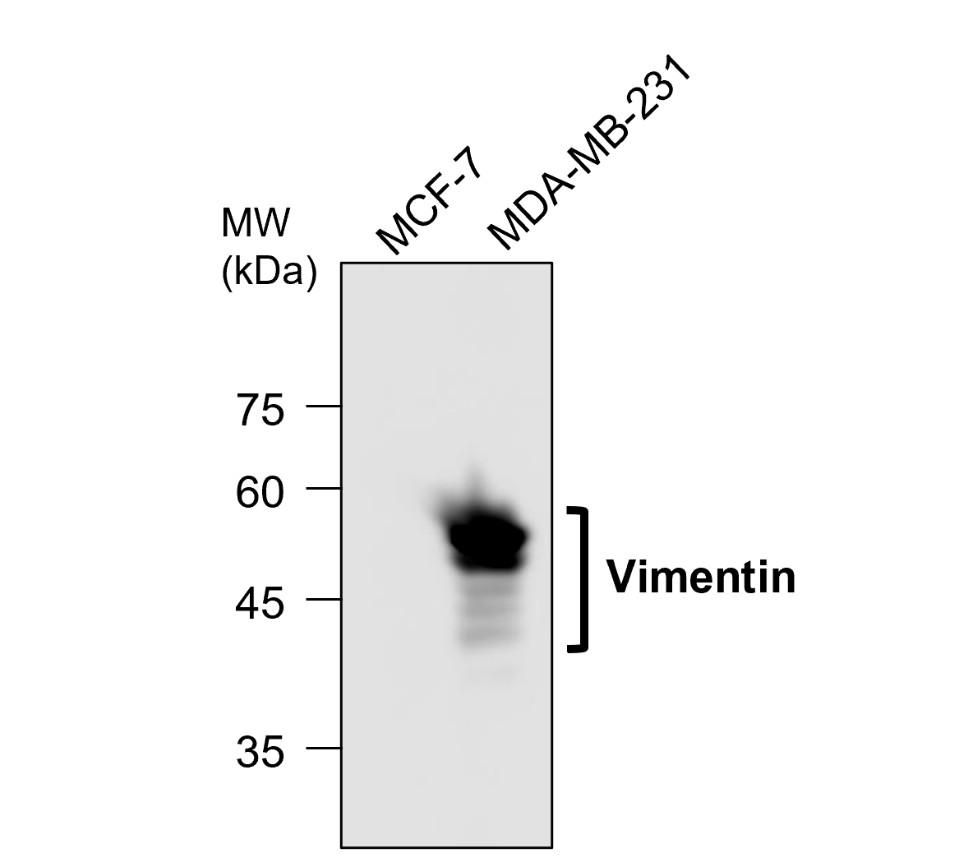 Vimentin antibody Vimentin antibody