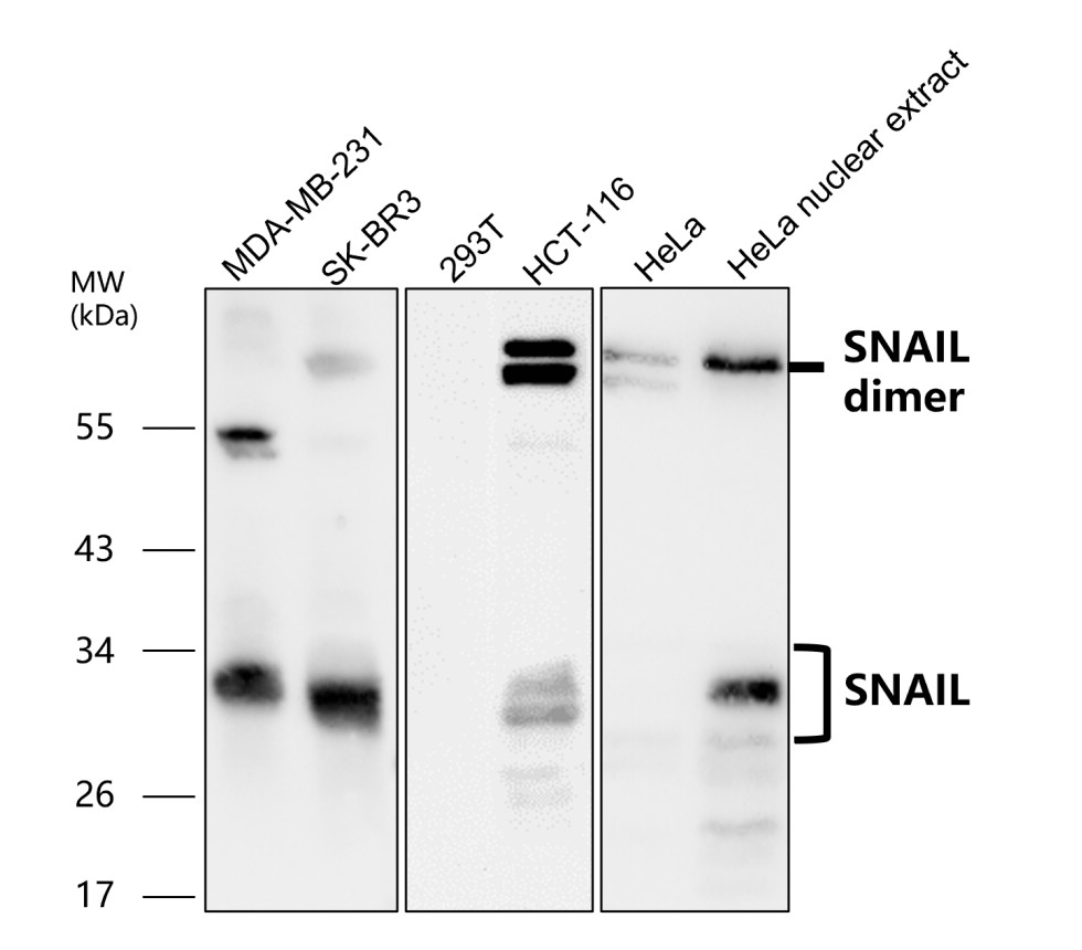 Snail antibody Snail antibody