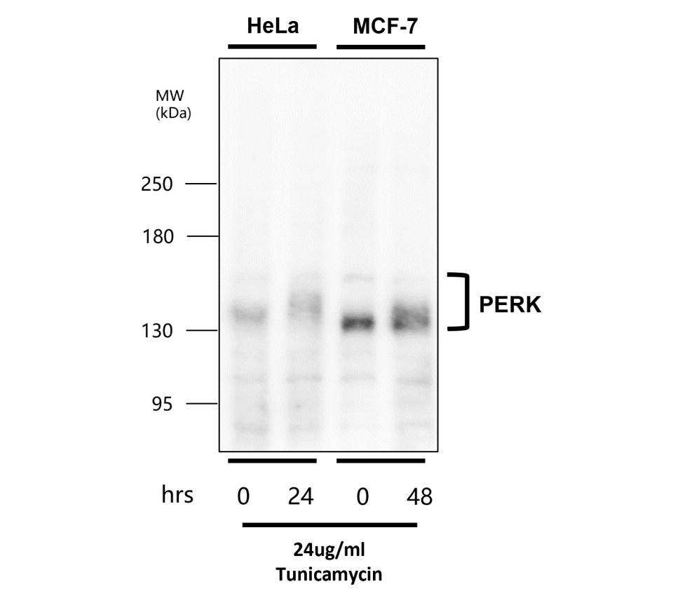 PERK antibody PERK antibody