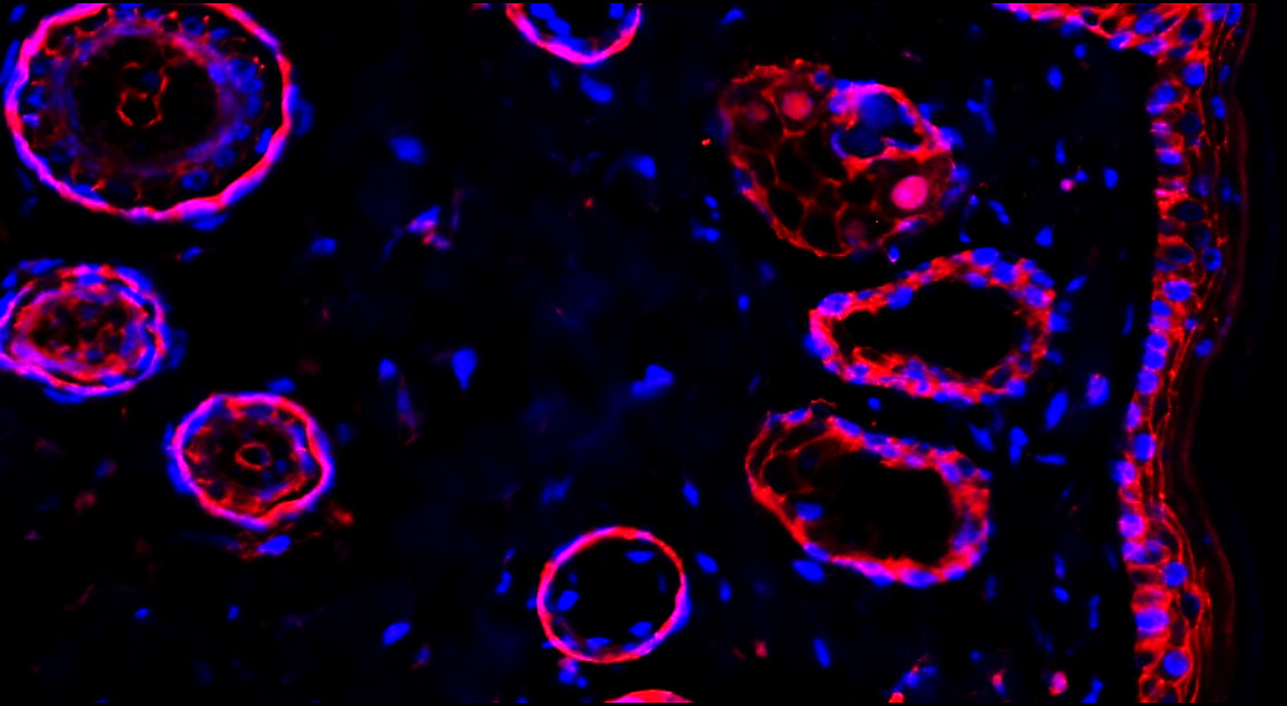 IR49-149 anti-Beta Catenin antibody_IF_Customer feedback
