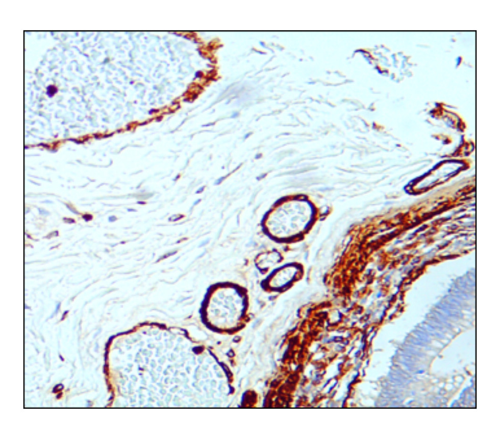α-Smooth Muscle Actin antibody α-Smooth Muscle Actin antibody