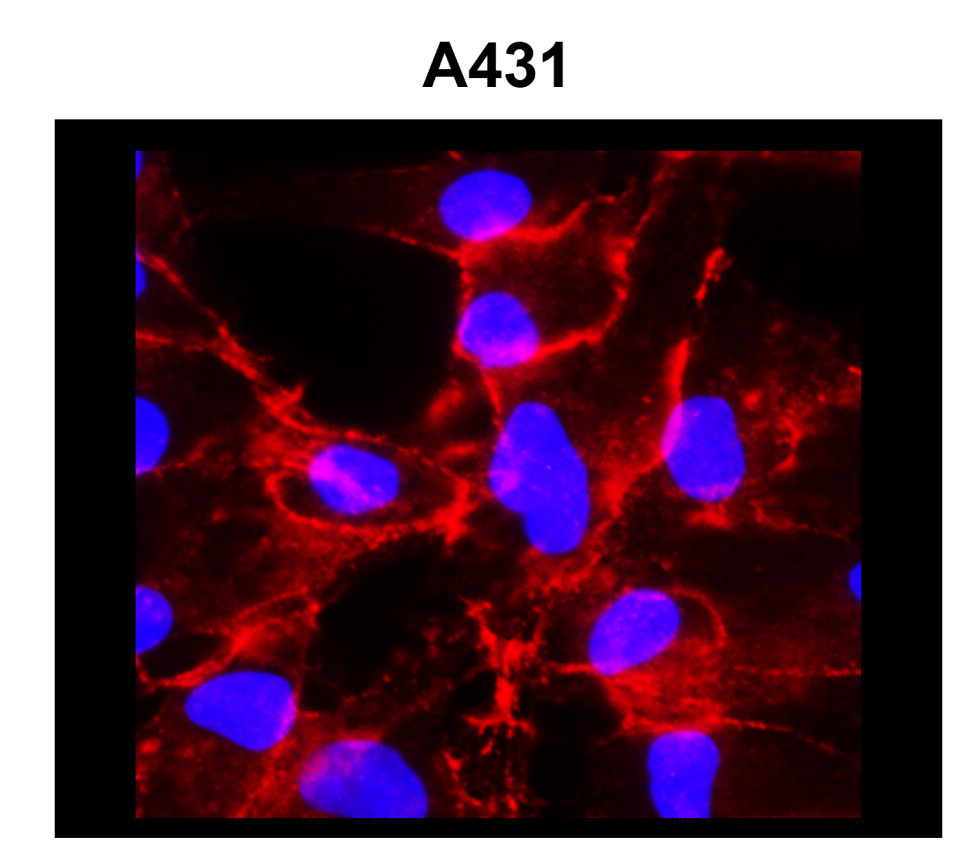 NaK ATPase alpha 1 antibody NaK ATPase alpha 1 antibody