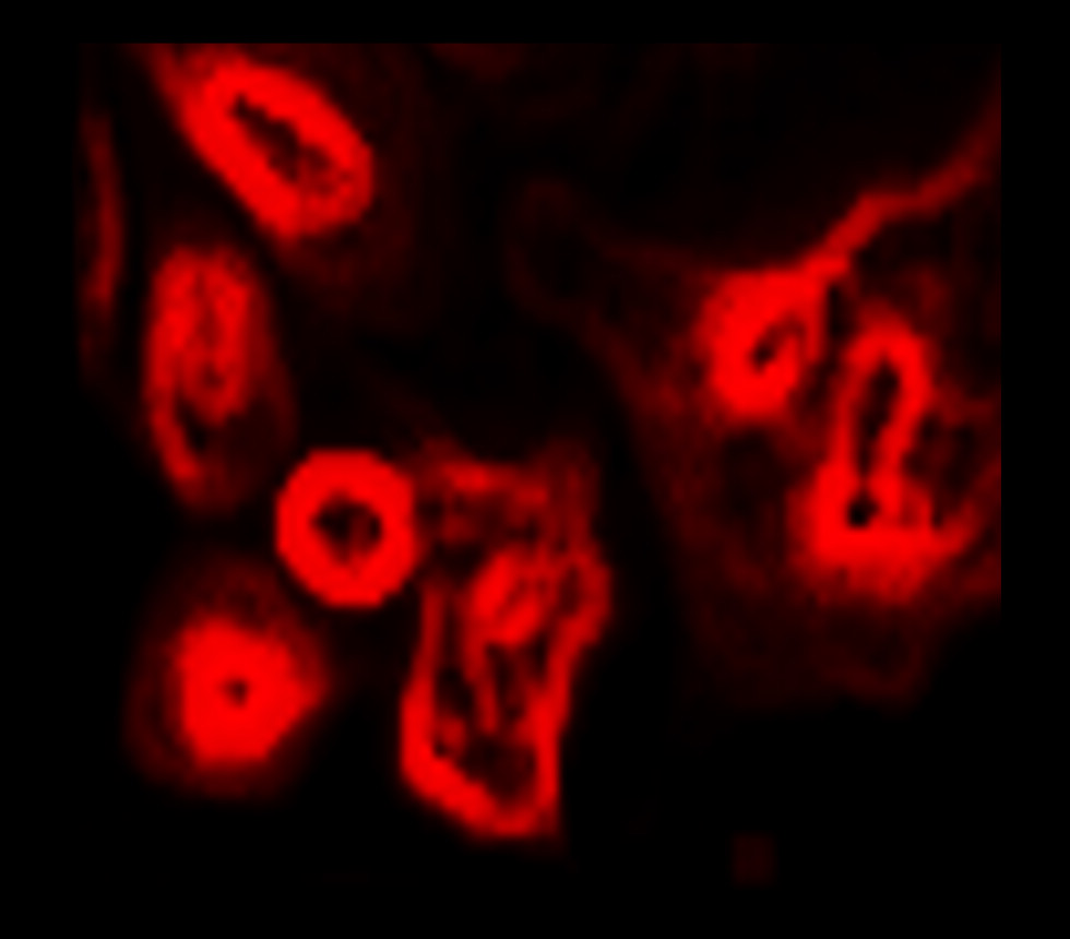 LAMP2, monoclonal antibody LAMP2, monoclonal antibody