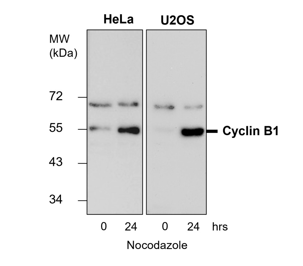 Cyclin B1 antibody Cyclin B1 antibody