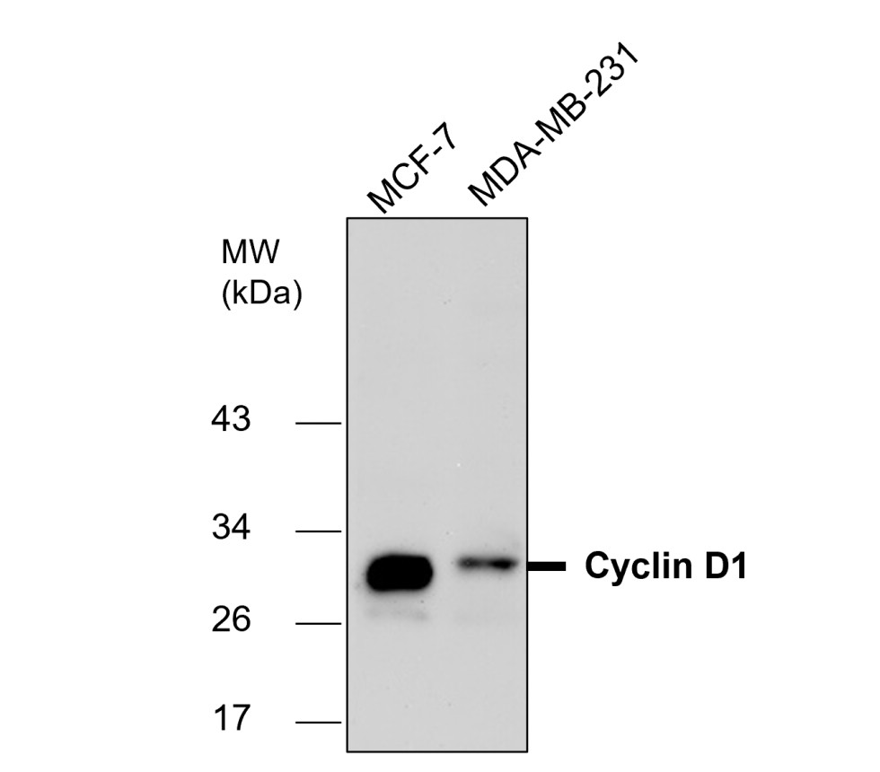 Cyclin D1 antibody Cyclin D1 antibody