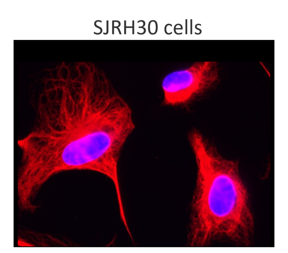 Desmin monolonal antibody Desmin monolonal antibody