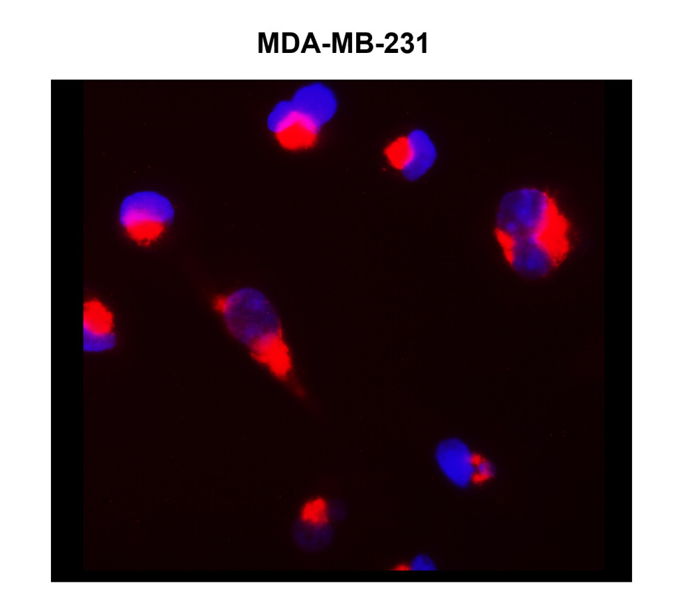 Cytokeratin 14/17 antibody Cytokeratin 14/17 antibody