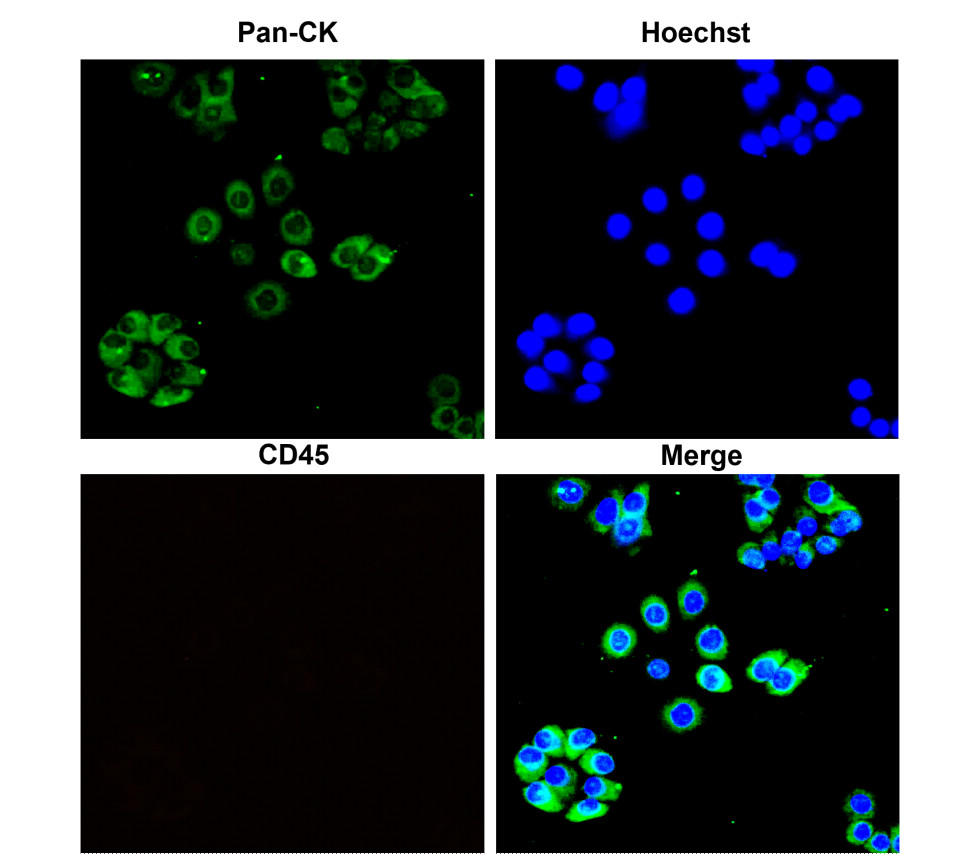 Pan- Cytokeratin antibody Pan- Cytokeratin antibody