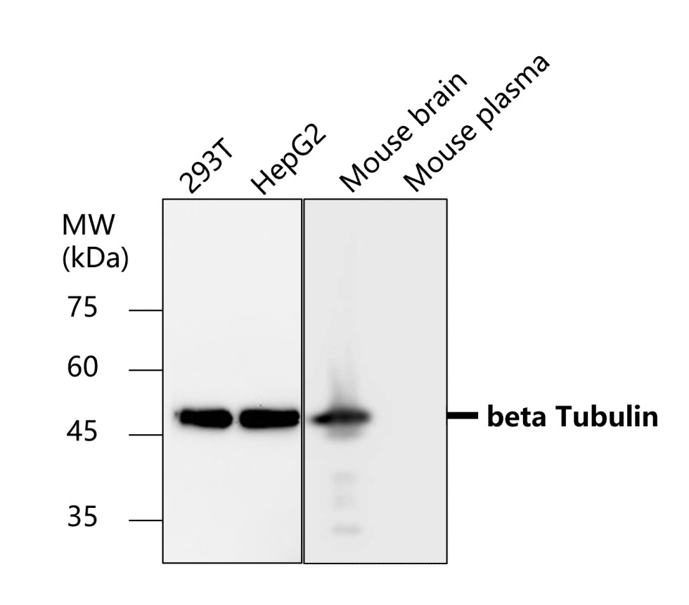 Beta-tubulin antibody Beta-tubulin antibody