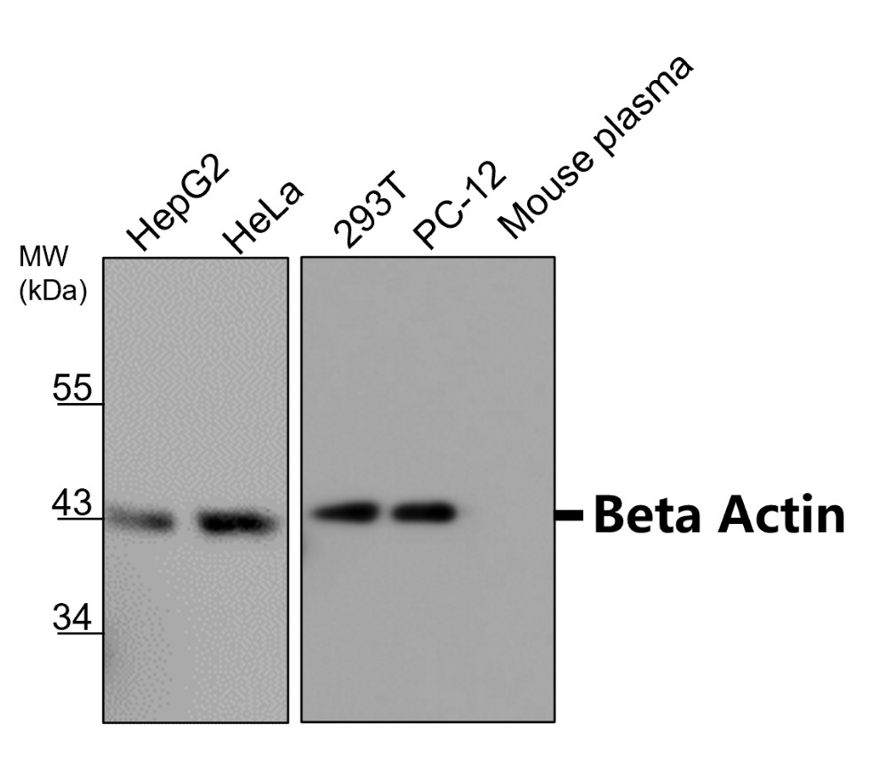 Beta-actin antibody Beta-actin antibody