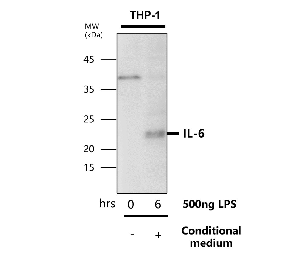 IL-6 antibody IL-6 antibody