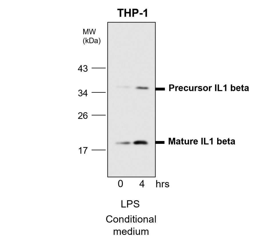 IL-1 beta antibody IL-1 beta antibody