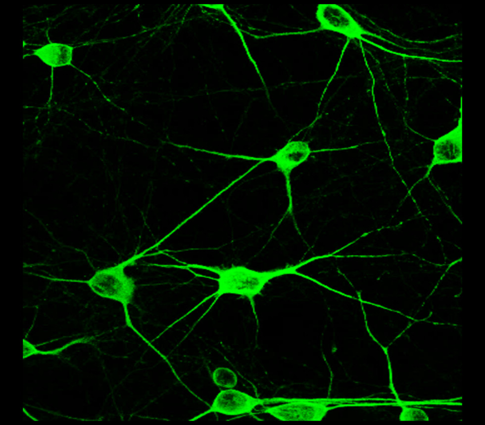 MAP2 antibody MAP2 antibody