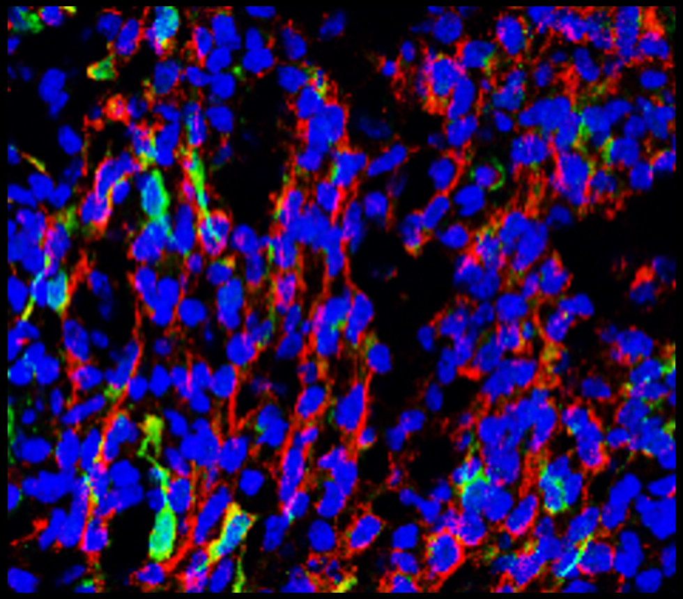 Tuj1 antibody Tuj1 antibody