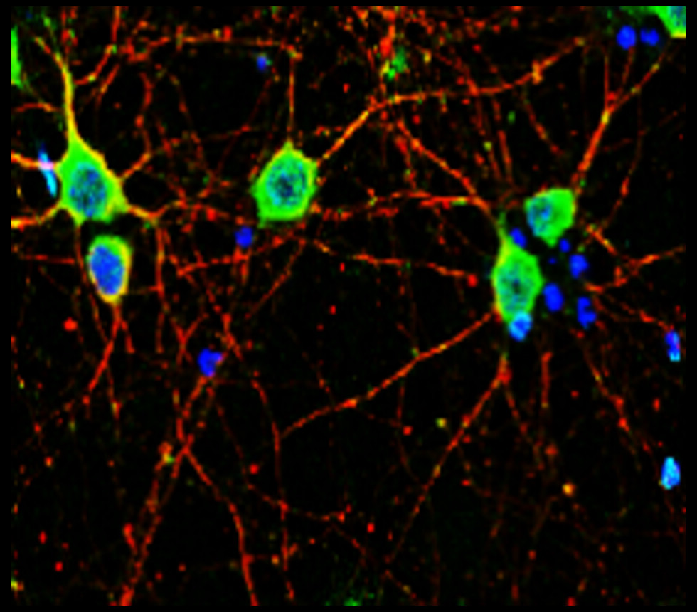 NF-L antibody NF-L antibody