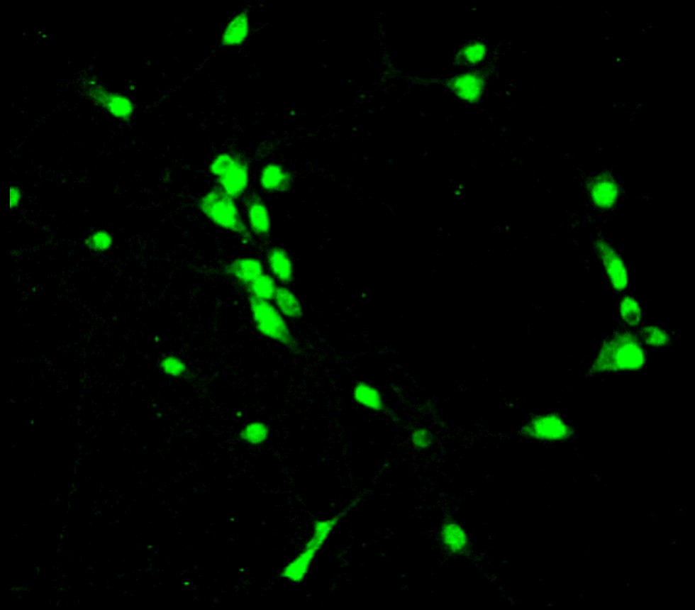 PAX6 antibody PAX6 antibody