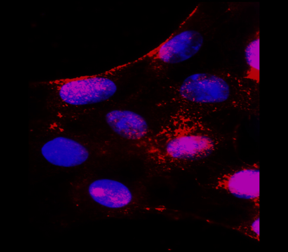 NOTCH1 antibody NOTCH1 antibody