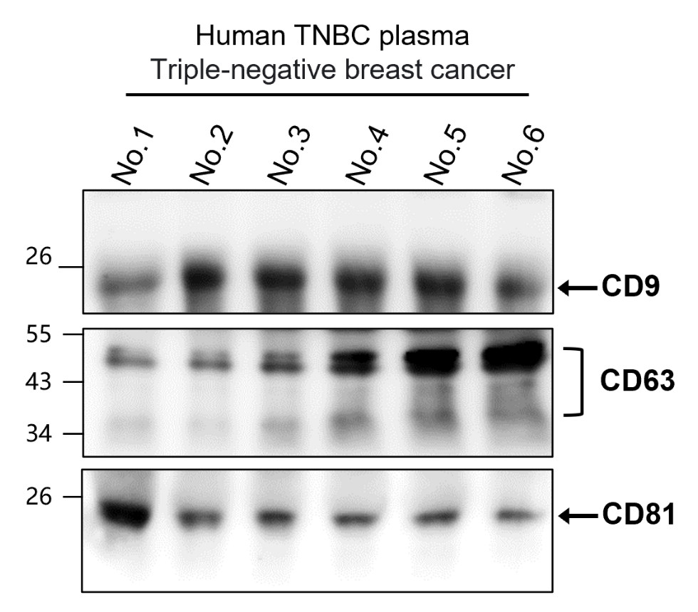 Customer Feedback IR300-981 anti-CD9 antibody WB image Customer Feedback IR300-981 anti-CD9 antibody WB image