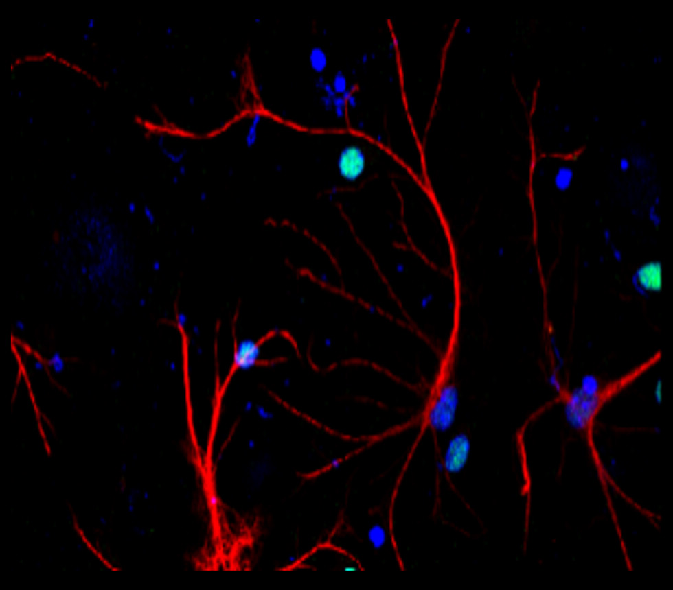 GFAP antibody GFAP antibody