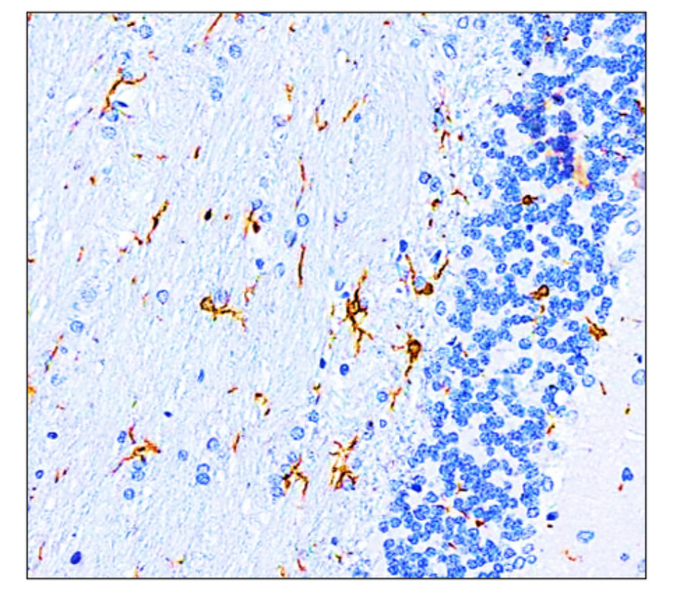 Iba1 antibody Iba1 antibody