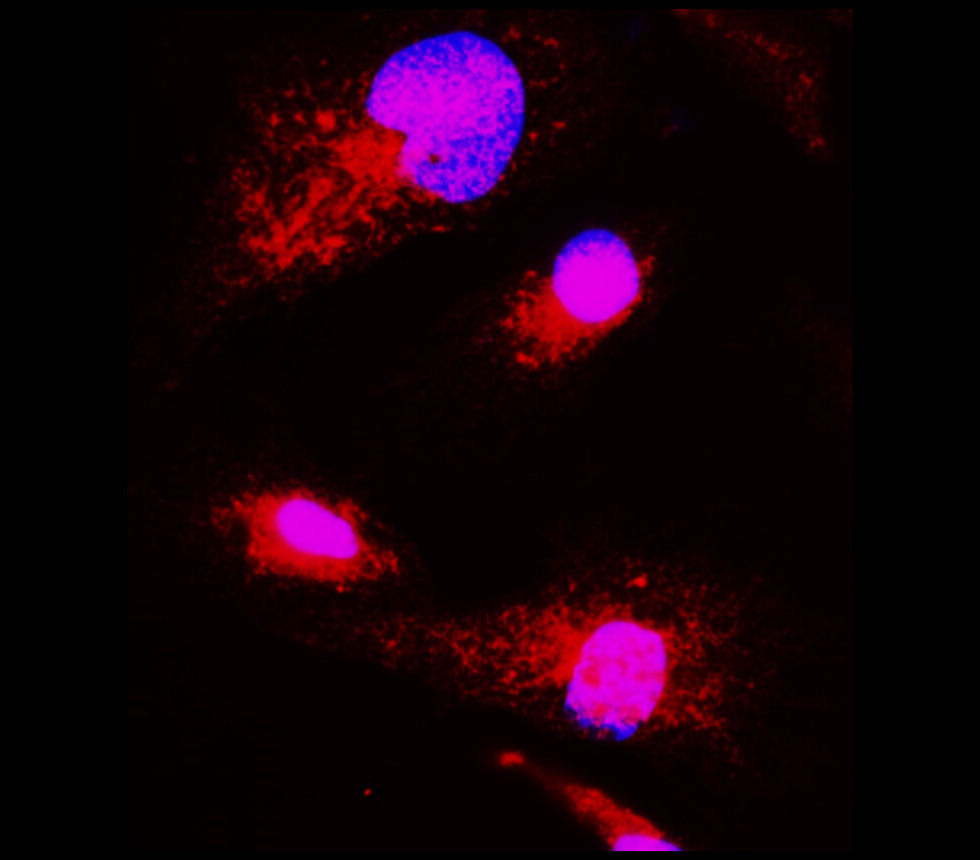 BDNF antibody BDNF antibody