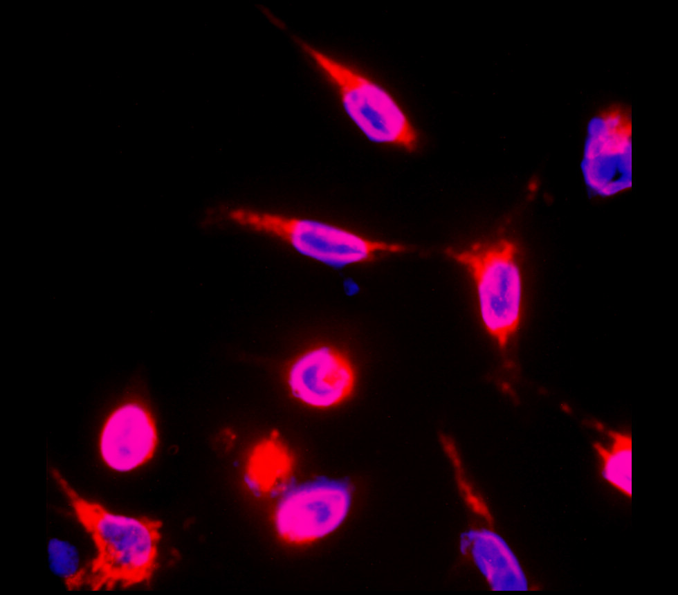 ICAM1 antibody ICAM1 antibody