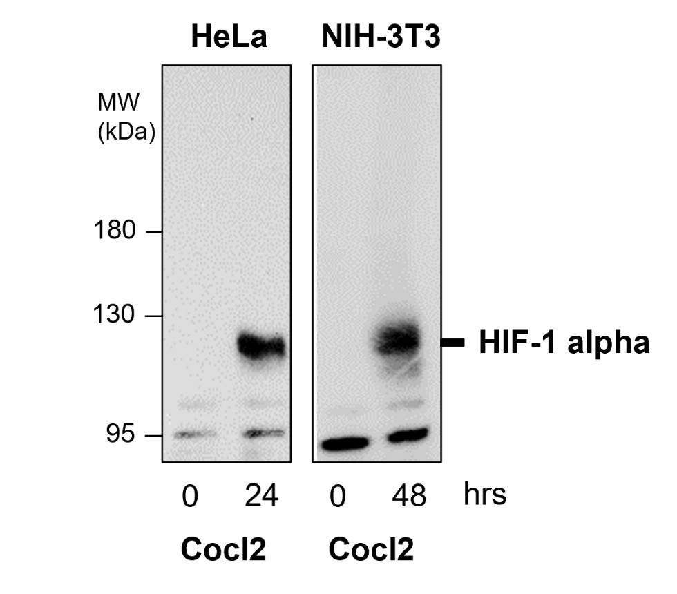 HIF1 alpha antibody HIF1 alpha antibody