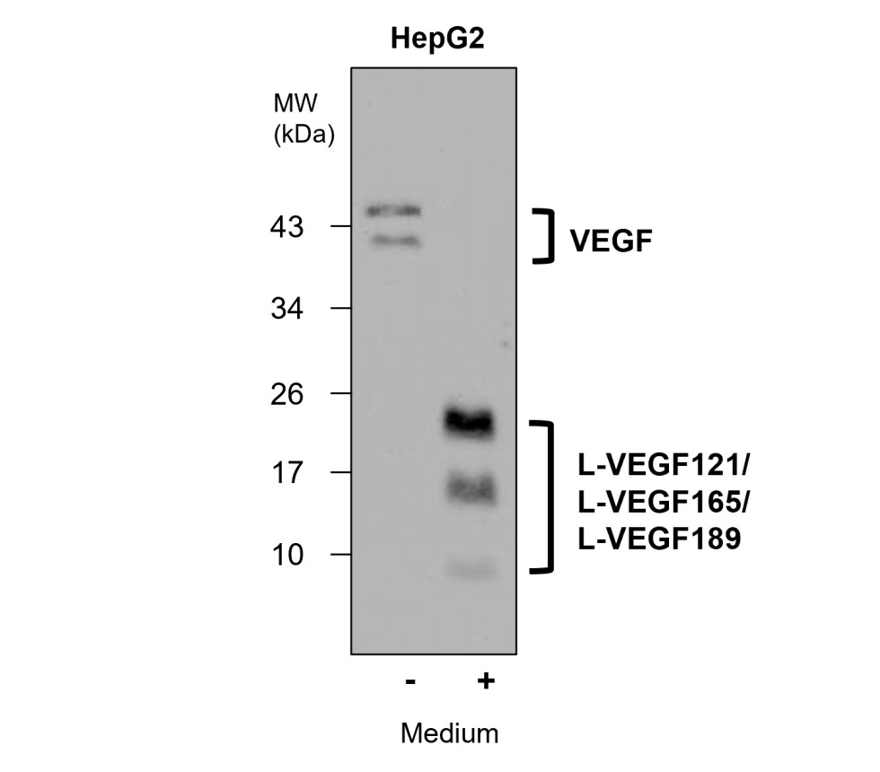 VEGF antibody VEGF antibody