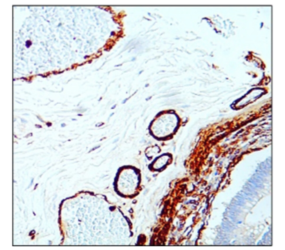 α-Smooth Muscle Actin antibody