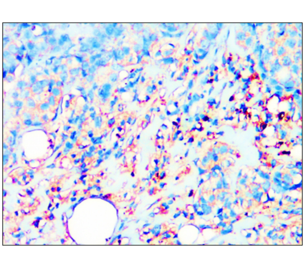 IR344-930 anti-PPARγ antibody IHC image IR344-930 anti-PPARγ antibody IHC image