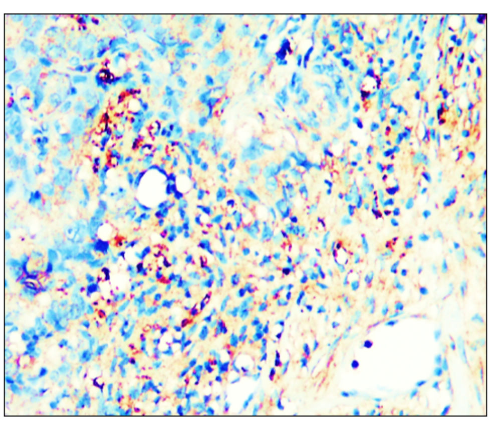 IR344-930 anti-PPARγ antibody IHC image