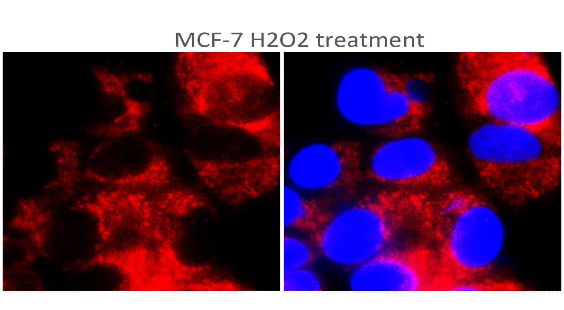 IR356-2 anti-TERT antibody ICC image IR356-2 anti-TERT antibody ICC image