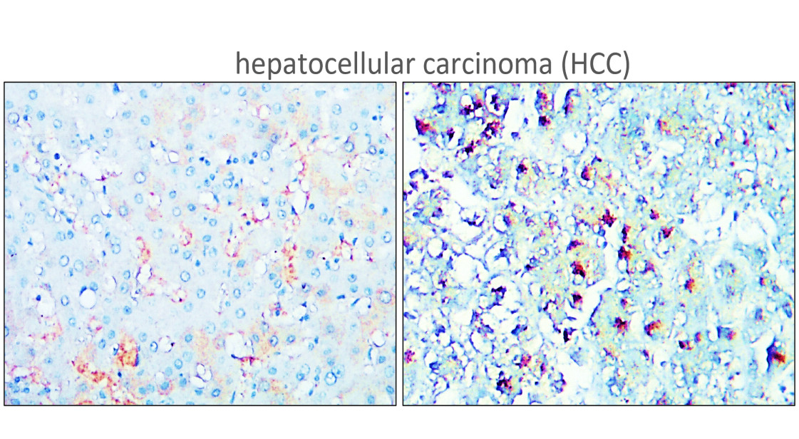 IR356-2 anti-TERT antibody IHC image IR356-2 anti-TERT antibody IHC image