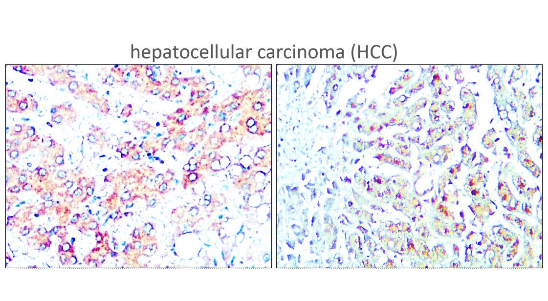 IR356-4 anti-TERT antibody IHC image