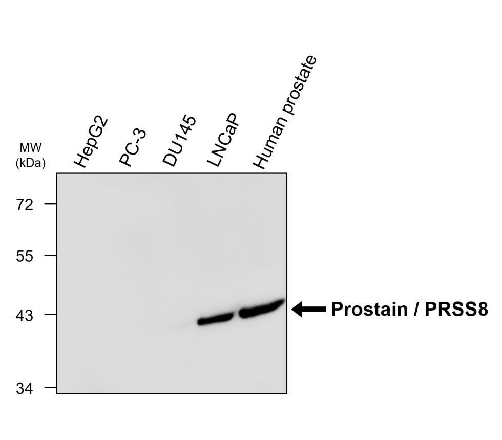 IRM203 Prostasin / PRSS8 antibody [YL11] WB image