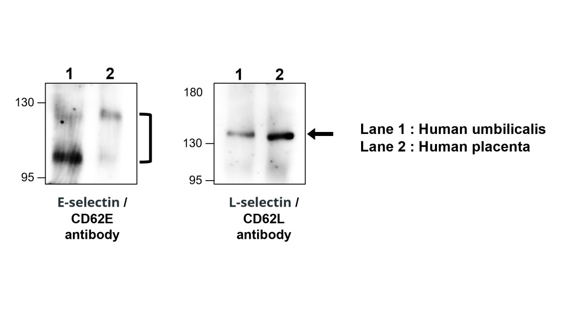 IR308-917 anti E-selectin / CD62E antibody WB image