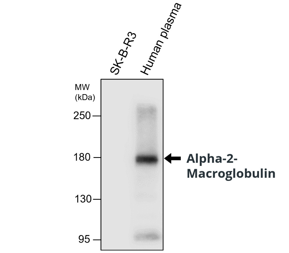 IRM204 alpha 2-macroglobulin antibody [15A04-1G3] WB image