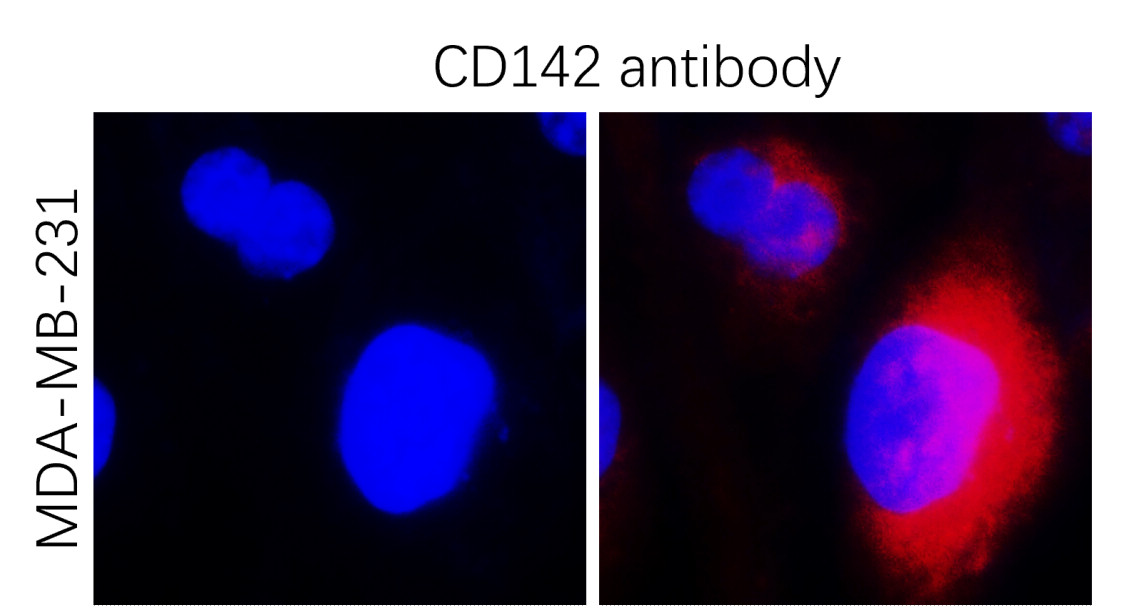 IR295-1 anti-Tissue Factor / CD142 antibody ICC/IF image