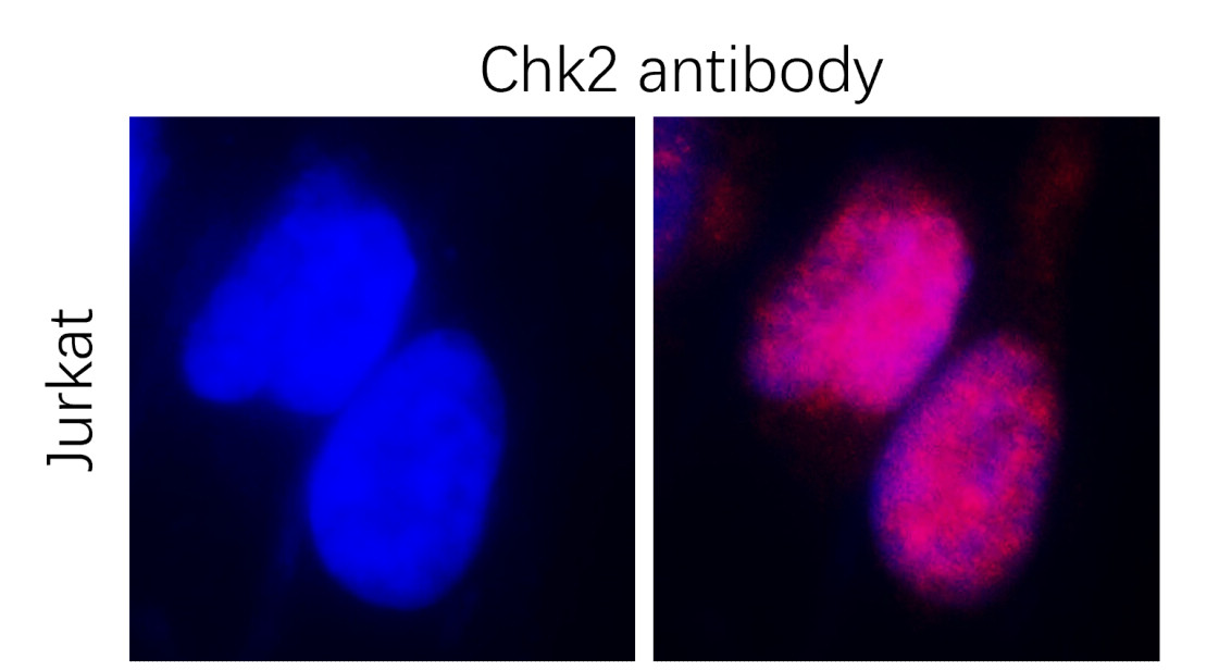 IR157-621 anti- Chk2 antibody ICC/IF image