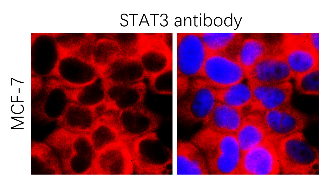 IR333-1045 anti-STAT3 antibody ICC/IF image IR333-1045 anti-STAT3 antibody ICC/IF image
