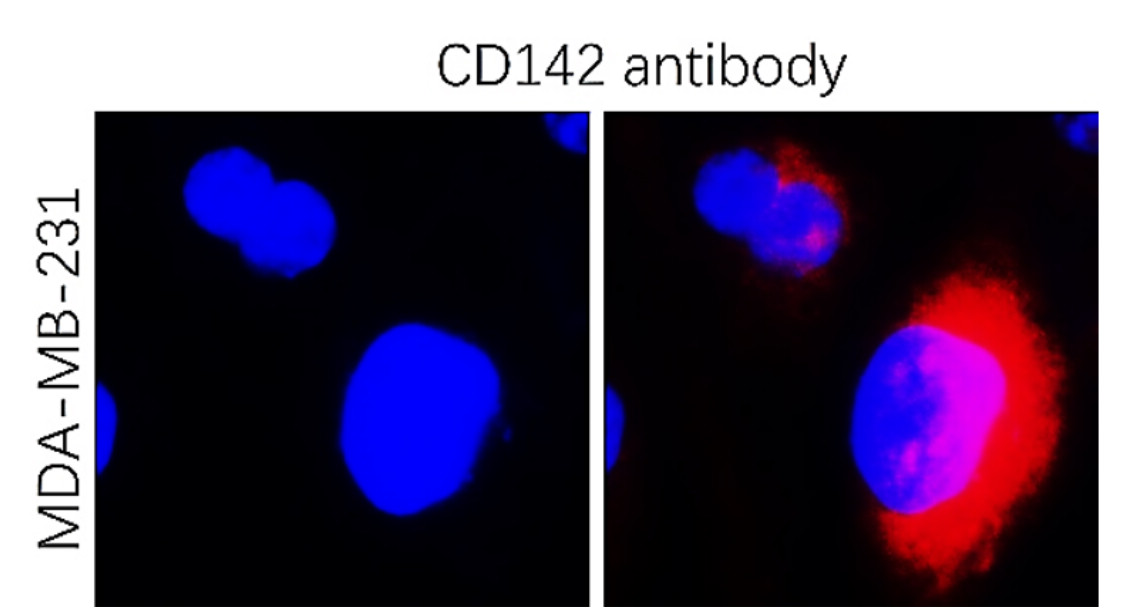 IR295-1-F555 anti- Tissue Factor / CD142 (HiLyte Fluor555 conjugated) antibody ICC/IF image