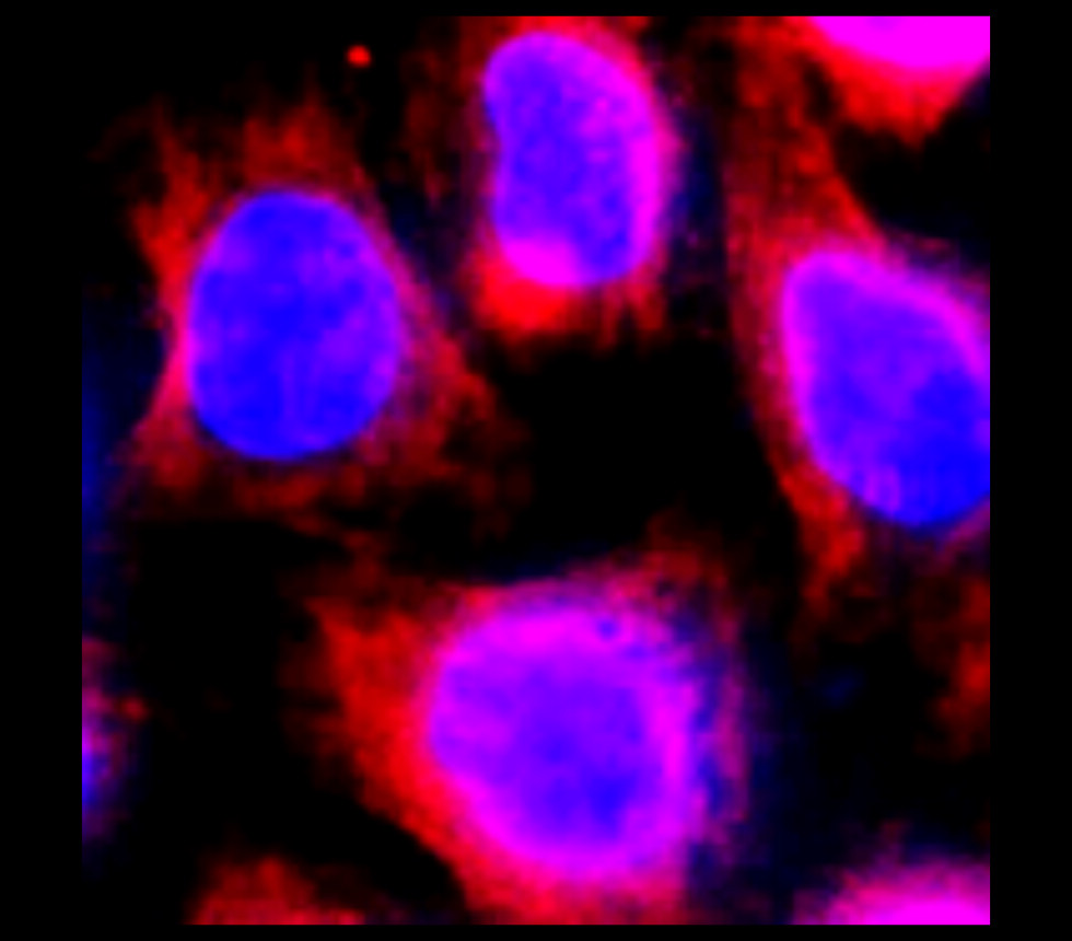 IR79-292-PE anti-VCAM-1 / CD106 PE conjugated antibody ICC/IF image IR79-292-PE anti-VCAM-1 / CD106 PE conjugated antibody ICC/IF image