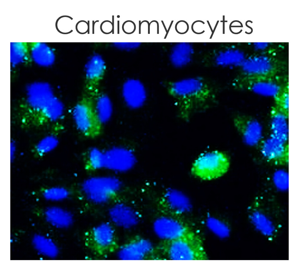 IR84-366 anti-LC3B antibody ICC/IF image